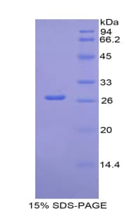 Human IL2RB / CD122 Protein (Recombinant His, N-Terminal)