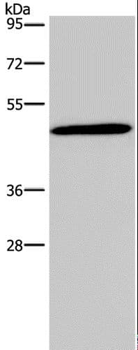 Polyclonal Rabbit anti-Human GCGR / Glucagon Receptor Antibody (IHC, WB)