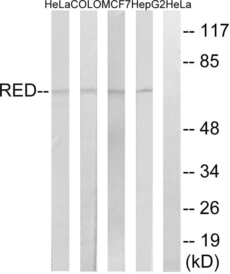 Polyclonal Rabbit anti-Human TRAG3 / CSAG2 Antibody (WB)