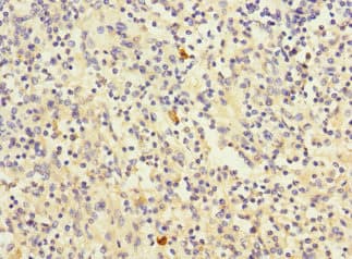 CD320 Antibody