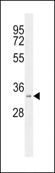 HSD17B11 Antibody (aa81-110)
