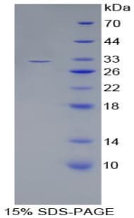 Human Complement C1s Protein (Recombinant His-T7)
