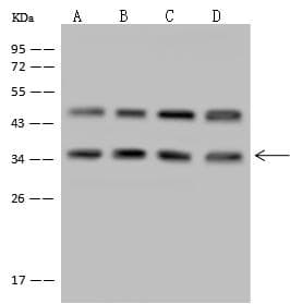 LZTFL1 Antibody