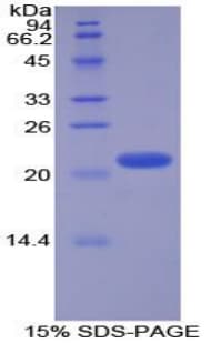 Human GCG / Glucagon Protein (Recombinant His-T7)