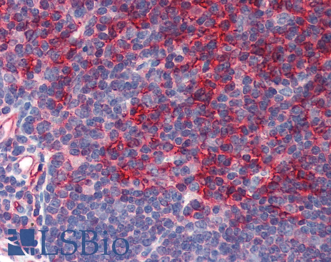IHC-plus™ Monoclonal Mouse anti-Human B2M / Beta 2 Microglobulin Antibody (IHC, WB)