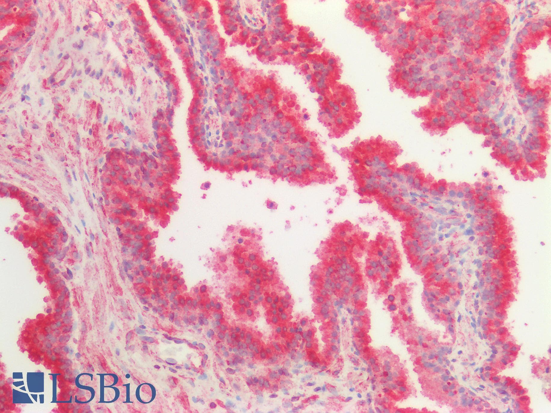 IHC-plus™ TUBB / Beta Tubulin Antibody (aa238-429)