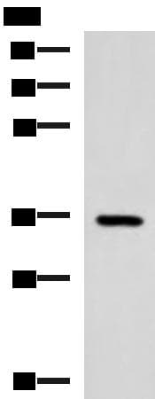 Polyclonal Rabbit anti-Human B3GAT1 Antibody (WB)