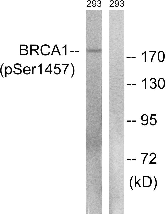 BRCA1 Antibody (phospho-Ser1457)