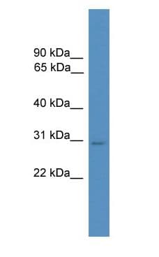Polyclonal Rabbit anti-Rat HES1 / HES-1 Antibody (C-Terminus, WB)