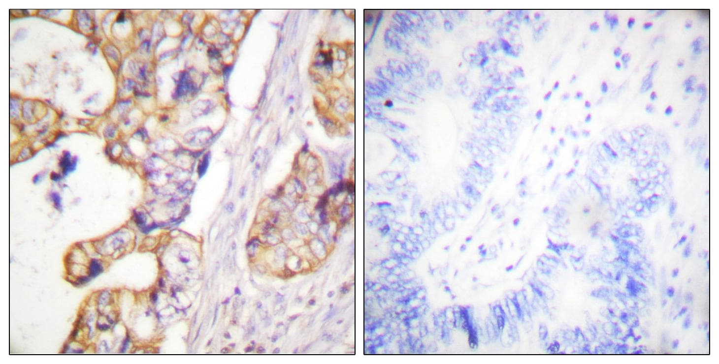 KRT8 / CK8 / Cytokeratin 8 Antibody (p431)