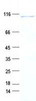 Human UTP14A Protein (Recombinant DDK,C-terminus)