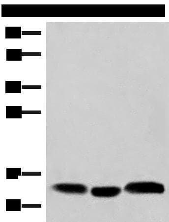 HBE1 / Hemoglobin Epsilon 1 Antibody