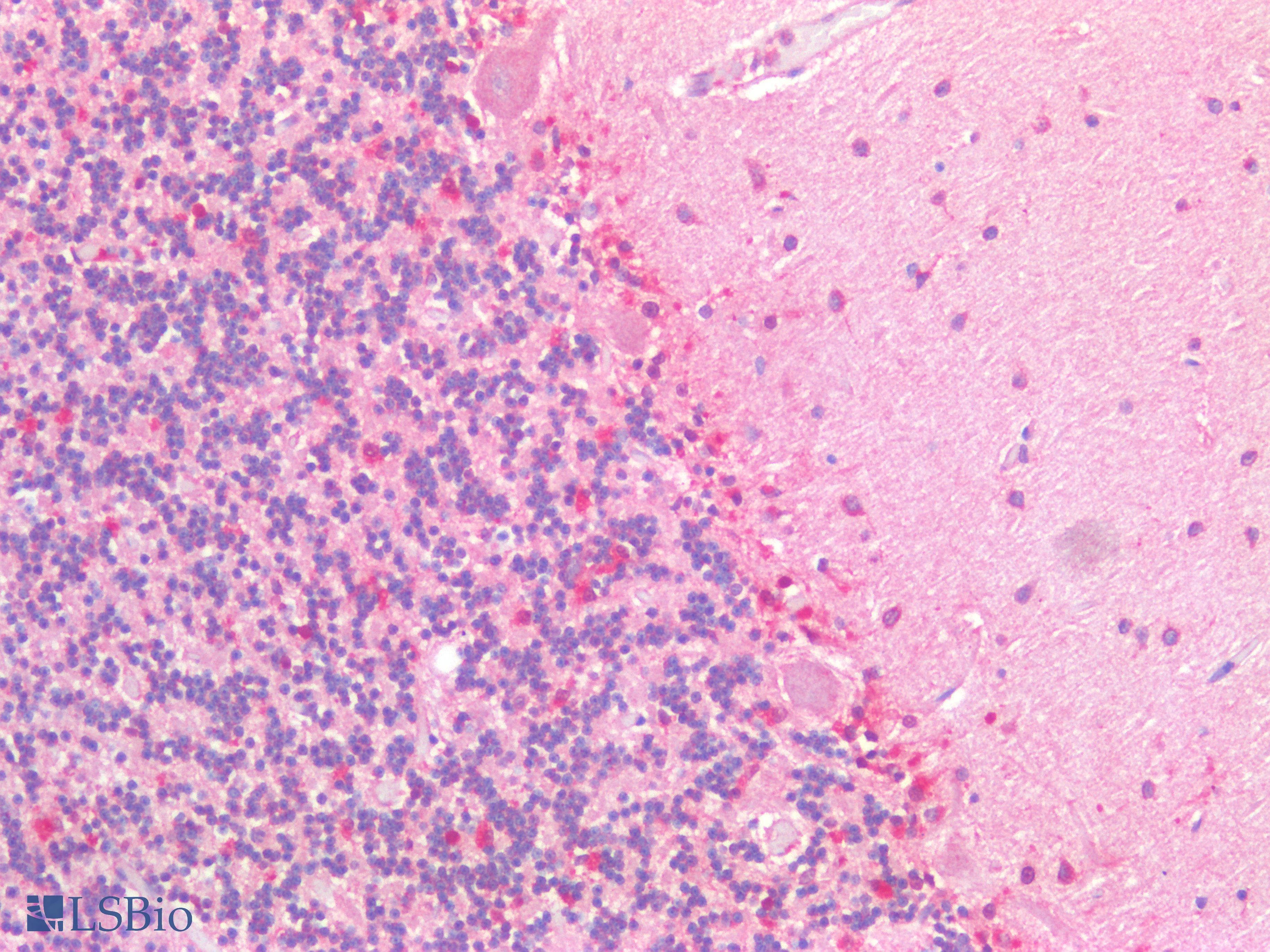 PathPlus™ Polyclonal Rabbit anti-Human HEXB Antibody (IHC)