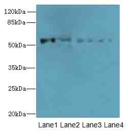CAP2 Antibody