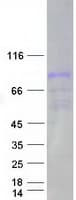 Human MST1 Protein (Recombinant Myc-DDK (Flag))
