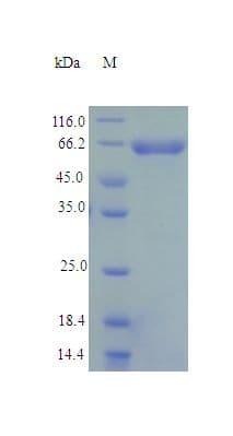 Human ME2 / Malate Dehydrogenase 2 Protein (Recombinant His)