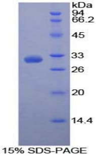 Human PVR / CD155 Protein (Recombinant His-T7)