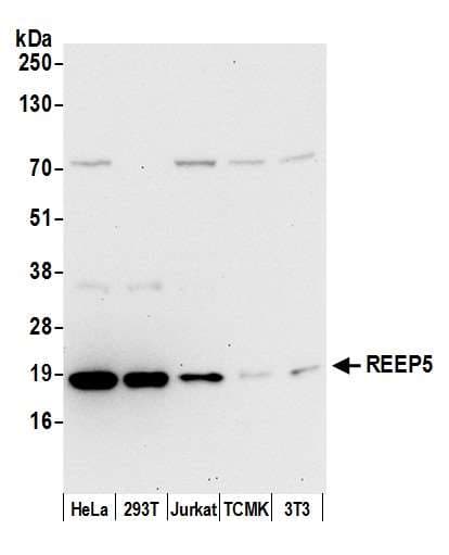 REEP5 Antibody (aa139-189)