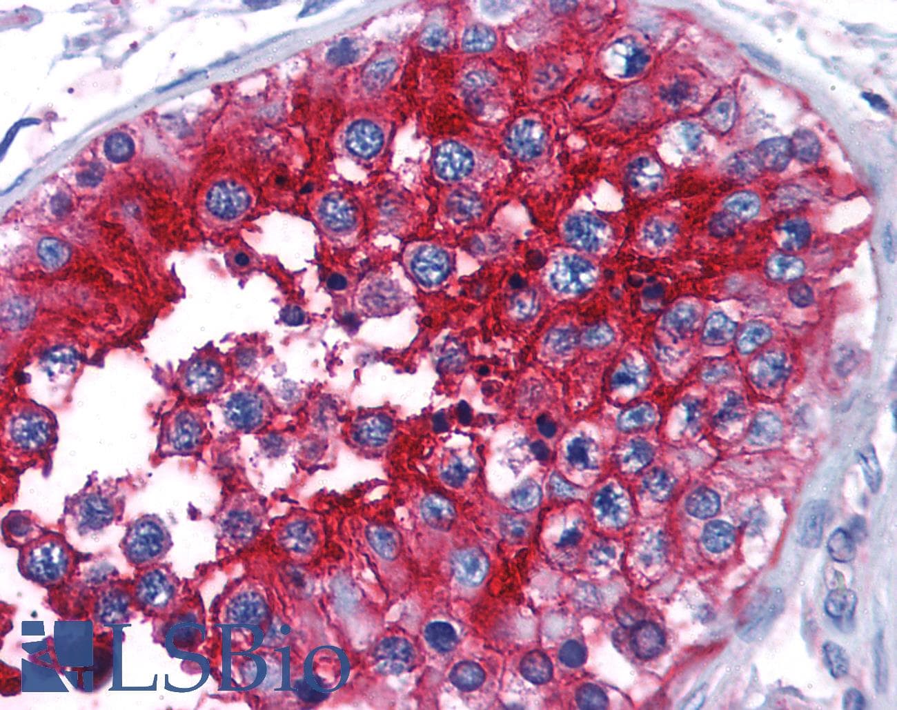IHC-plus™ Basigin / Emmprin / CD147 Antibody (clone HIM6)