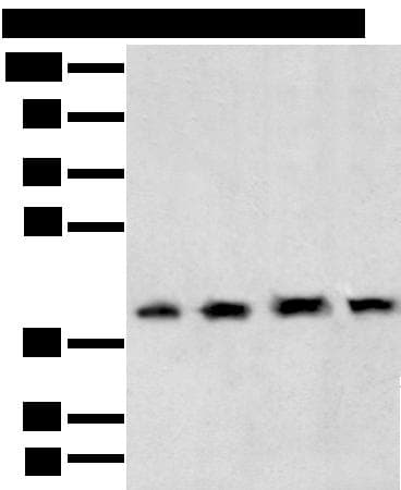TBP / GTF2D Antibody