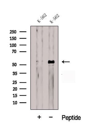Polyclonal Rabbit anti-Human CDR2L Antibody (WB)