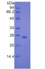 Mouse GPC4 / Glypican 4 Protein (Recombinant His)
