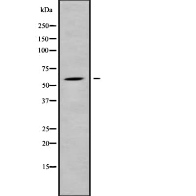 CDY1 Antibody