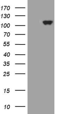 KEL / CD238 Antibody (aa166-420, clone OTI8E1)