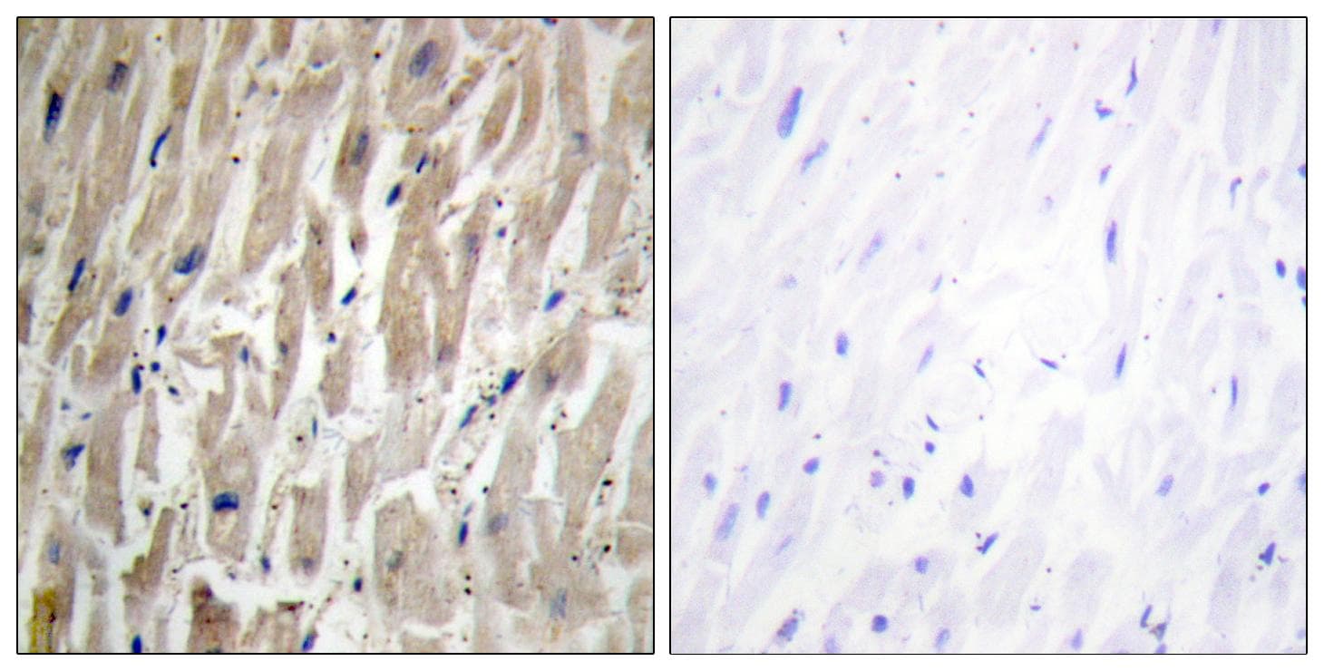 CYP2J2 Antibody