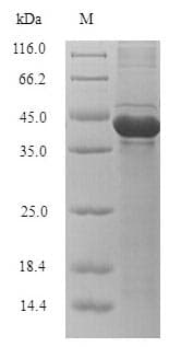 Klebsiella KPC, KPC-2 Protein (Recombinant 6His-SUMO, N-terminus)