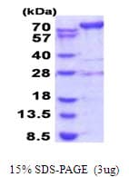Human AMPD2 Protein (Recombinant His)