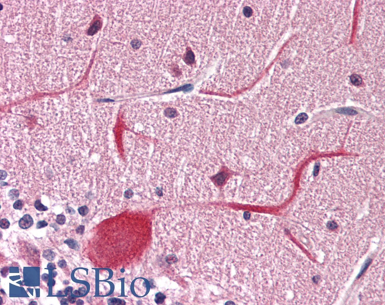 IHC-plus™ METTL14 Antibody