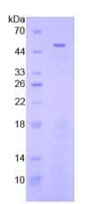 Human FGL2 Protein (Recombinant His-T7)