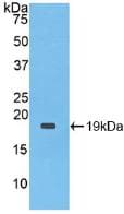IL1RN Antibody (Biotin)