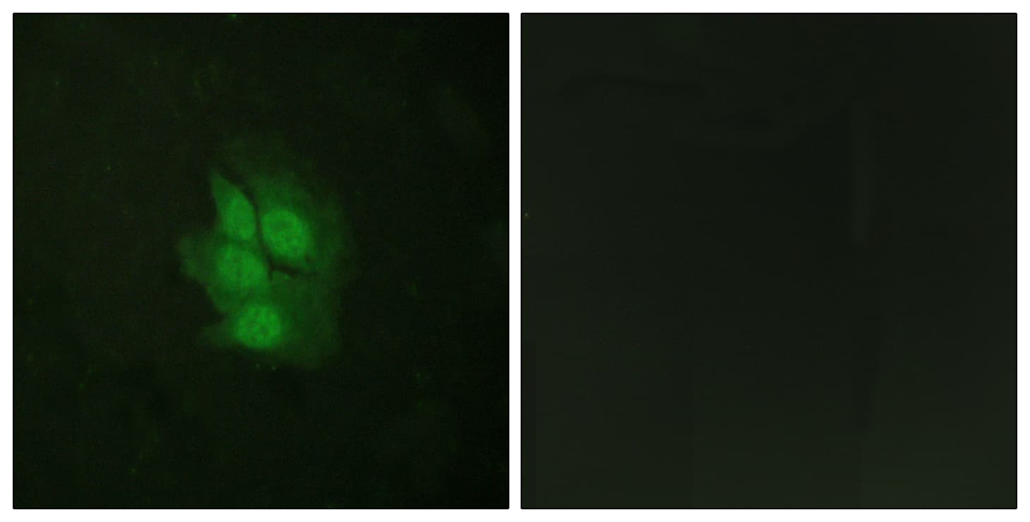 Polyclonal Rabbit anti-Human TP53 / p53 Antibody (phospho-Ser392, IHC, IF, WB)