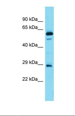 FAM110D / GRRP1 Antibody (N-Terminus)
