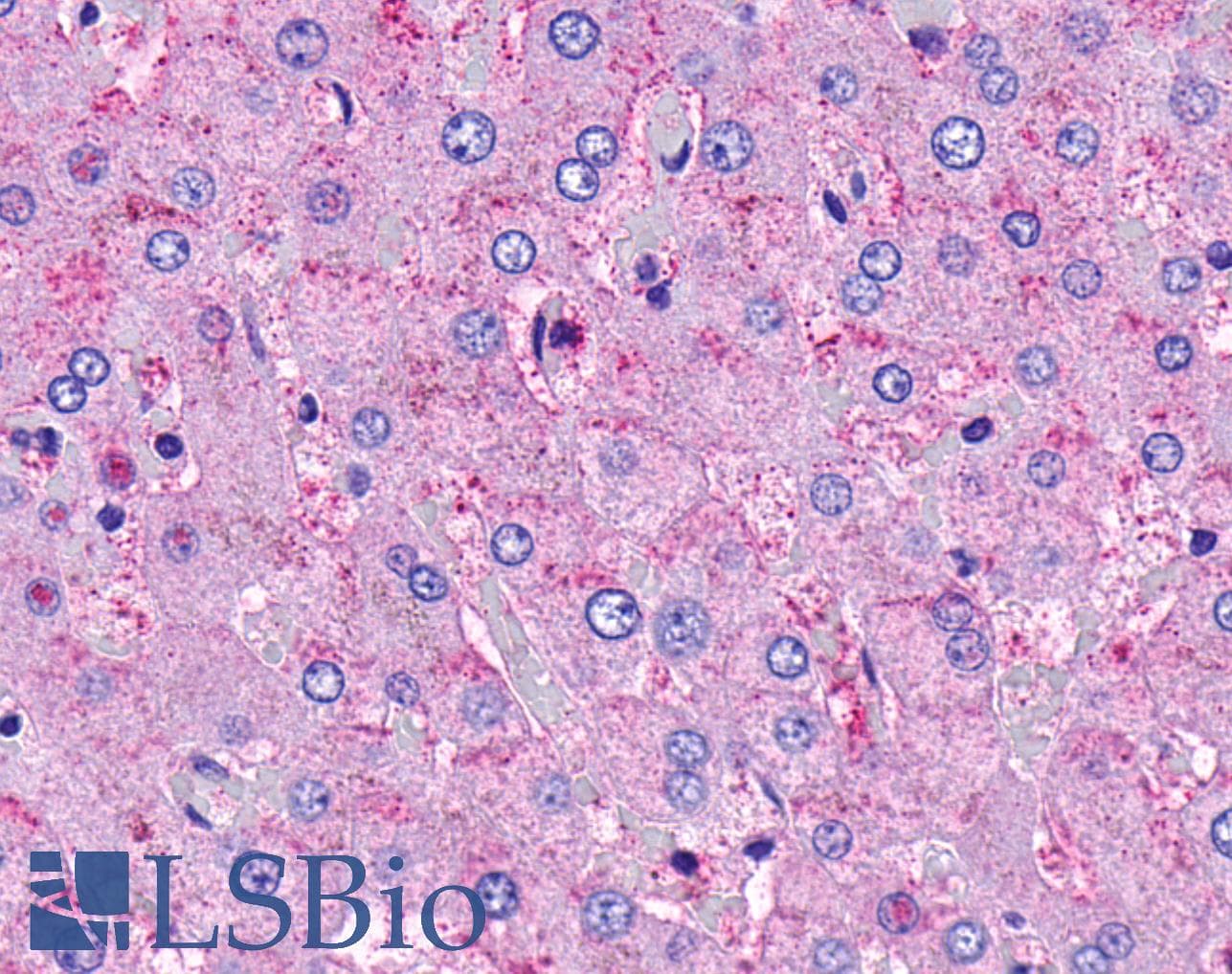 PathPlus™ F2R / Thrombin Receptor / PAR1 Antibody (N-Terminus)