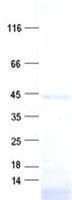 Human DENND1B Protein (Recombinant His, N-Terminal)