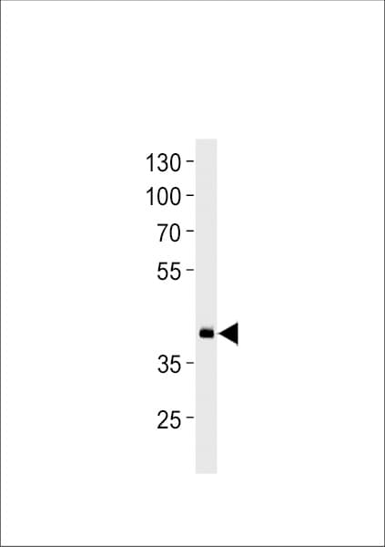 hoxd11a Antibody (aa128-155)