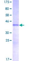 Human HMGIY / HMGA1 Protein (Recombinant GST)