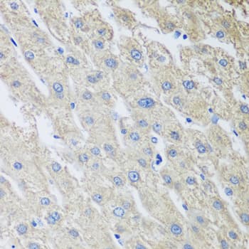 Polyclonal Rabbit anti-Mouse MLKL Antibody (IHC, WB)
