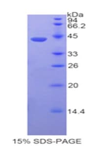 Human FBLN4 / EFEMP2 Protein (Recombinant His-GST)