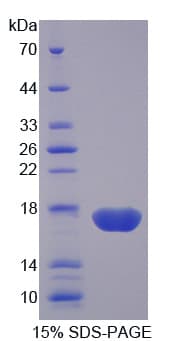 Human PDIA4 / ERP72 Protein (Recombinant His-T7)