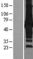 Human SQSTM1 Protein (Over-Expression Lysate Myc-DDK (Flag))