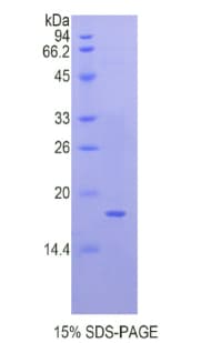 Human QSOX1 / QSCN6 Protein (Recombinant His)