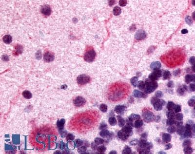 IHC-plus™ Polyclonal Rabbit anti-Human OPRK1 / Kappa Opioid Receptor Antibody (Extracellular Domain, IHC)
