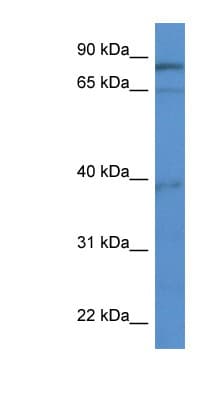 ZCCHC7 Antibody (aa453-502)