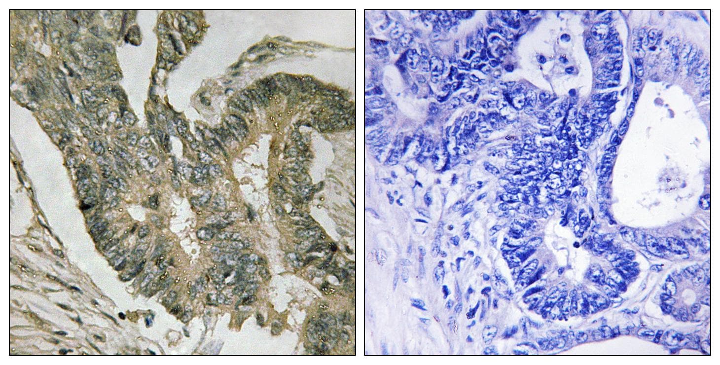 Polyclonal Rabbit anti-Human ALDOC / Aldolase C Antibody (IHC)