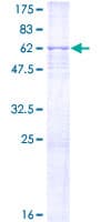 Human CDK7 Protein (Recombinant GST)