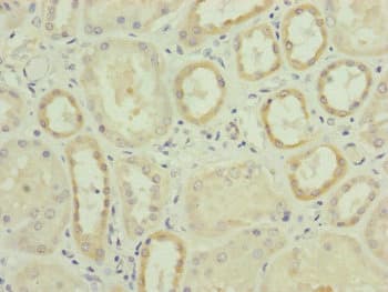 RNF139 / TRC8 Antibody